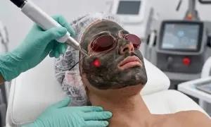 al-shami-medical-center_dealimage_health-and-clinic_carbon-laser-1copy.webp