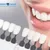 avenues-dental_-dealimage_health_veneer-copy.jpg