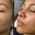 golden-gate-_deal-image_beauty-spa-_hydrafacial2.jpg