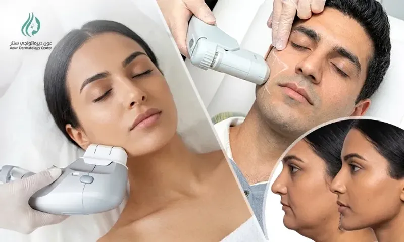 HIFU Skin Tightening for Ladies & Men at Aoun Dermatology Center!
