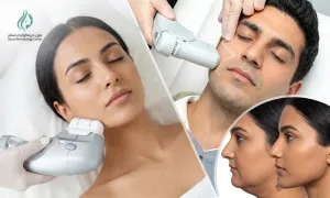 aoun-derma_dealimage_healthclinic_hifu-2-copy.webp
