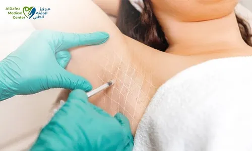 Stay Dry & Confident with Hyperhidrosis Botox Treatment for Him & Her - Al Dafna Medical Center!