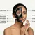 aoun-derma_dealimage_healthclinic_carbon-laser5.jpg