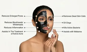aoun-derma_dealimage_healthclinic_carbon-laser5.jpg