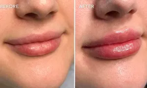 nesma-medical_dealimage_health-clinic_lips-1-copy.webp
