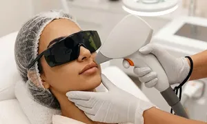 nesma-medical_dealimage_health-clinic_laser-hair-removal-2.jpg