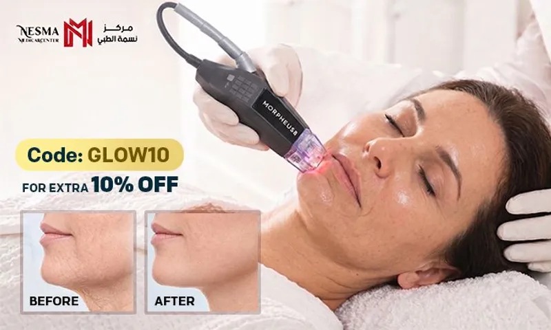 Ageless Skin Starts Here: Morpheus Skin Tightening, Lifting & Glowing Treatment for Face & Neck! for Ladies & Men!