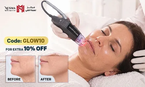 Ageless Skin Starts Here: Morpheus Skin Tightening, Lifting & Glowing Treatment for Face & Neck! for Ladies & Men!