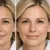 queens-derma_-dealimage_healthandclinic_botox-2copy.jpg