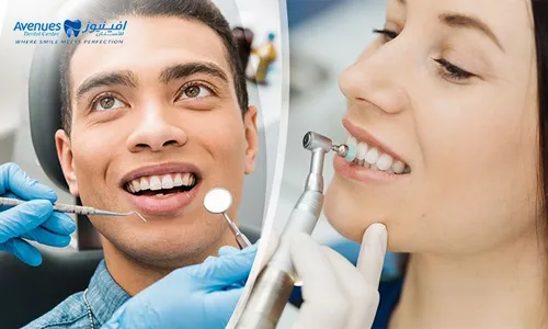 Dental Scaling & Polishing + Consultation at Avenues Dental!