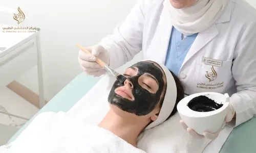 Carbon Laser Skin Refining Treatment at Al Dimashqui Clinic!