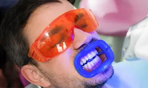 ocean-medical_dealimage_health-and-clinic_flash-teeth-2copy.jpg