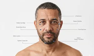 nesma-medical_dealimage_health-clinic_age-hifu-2-copy.jpg