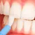 pioneer_dealimage_health-clinic-_-teeth-5-copy.jpg