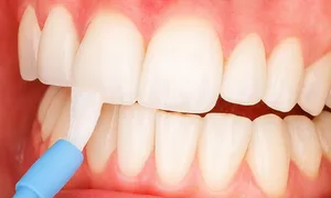 pioneer_dealimage_health-clinic-_-teeth-5-copy.jpg