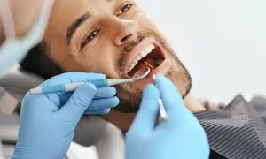 dafna-medical_-dealimage_health_scaling-teeth-2-copy.jpg