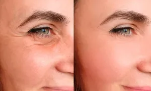 nesma-medical_dealimage_health-clinic_botox-3-copy.jpg