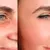 nesma-medical_dealimage_health-clinic_botox-3-copy.jpg