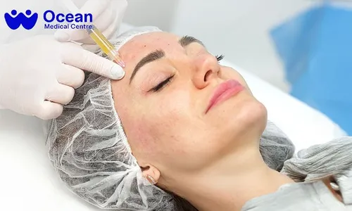 PRP for Face OR Hair + Consultation at Ocean Medical Center!
