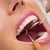 al-dafna-medical-center-dental-scaling-deals-image-02.jpg