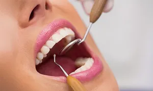 al-dafna-medical-center-dental-scaling-deals-image-02.jpg