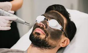 dafna-medical_-dealimage_health_carbon-laser-3-copy.jpg